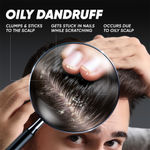 Buy Head and Shoulders Deep Cleanse Dandruff Shampoo,340 ml,Oxygenated Charcoal,Oily Scalp Dandruff Shampoo - Purplle