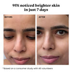 Buy Foxtale Daily Glow Combo – Face Wash + Moisturizer for Daily Glow 150 ml - Purplle