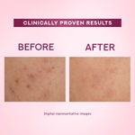 Buy Ponds Bright Beauty Anti-Spot Serum Cream with Niacinamide and SPF 15 PA++ |Fades Dark Spots |Boosts Glow and Enhances Skin Radiance | 50 gm - Purplle