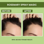 Buy Alps Goodness Rosemary Water (100 ml) | Rosemary water for hair | Hair Spray for Regrowth | Hair Growth Expert | Viral Rinse | Bestselling Spray (ST) - Purplle