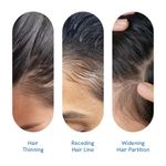 Buy Be Bodywise Hair Growth Serum Roll On - With 3% Rosemary for New Hair Growth - Pack of 2, 25 ml each - Purplle