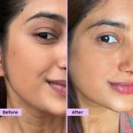 Buy PLIX Jamun Clarifying Fruity Toner (150 ml)|With Niacinamide & Jamun Extract|Targets Clogged Pores & Smoothens Skin|For Oily & Acne Prone Skin|Alcohol Free, For Women & Men - Purplle