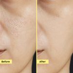 Buy PLIX Pineapple PHA 3% Alcohol Free Face Toner (150 ml) | Pore Tightening & Mild Exfoliation for Oily, Acne Prone, Sensitive & Normal Skin | Hydrating Face Toner for Glowing Skin - Purplle
