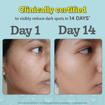 Buy Chemist At Play 10% Vitamin C Face Serum | Brightens & Gives Glow |Fades Dark Spots | For All Skin Types 10 ml - Purplle