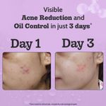 Buy Chemist At Play 2% Salicylic Acid Face Serum | Treats Active Acne | Controls Excess Oil | Fades Acne Marks | Improves Skin Texture | 10 ml - Purplle