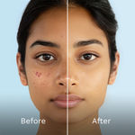 Buy Pilgrim Face Serum Combo | 10% Niacinamide + 10% Vitamin C | Glowing & Clear Skin | Pack of 2 (10 ml Each) - Purplle