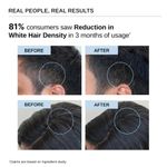 Buy Bare Anatomy Advanced Anti-Grey Serum | Reduces Hair Greying | Silverfree Peptide + Biotin + Rosemary | Fast Absorbing, Odorless, Non-Sticky | Clinically proven formula For Men & Women | 50 ml - Purplle