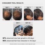 Buy Bare Anatomy Advanced Hair Growth Serum | 3% Redensyl + 4% Anagain + 3% Baicapil + 1% Capilia Longa, Rosemary, Biotin & Rice Water | Hair Growth & Hair Fall Control Serum for Women & Men | 20 ml - Purplle