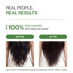 Buy Bare Anatomy Anti-Dandruff Hair Conditioner with Biotin, Salicylic Acid & Rosemary | Removes Flaky Buildup | Moisturizes & Strengthens Hair | Reduces Frizz & Breakage | For All Hair Types | 175 ml - Purplle