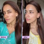 Buy PLIX Jamun Face Wash (100 ml) and Active Acne Serum (30 ml) Combo of 2 For Active Acne & Oil Control, For Breakouts | Oily & Acne Prone Skin | Women & Men - Purplle