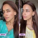 Buy PLIX Jamun Cleanser (100 ml) & 2% Salicylic Acid Serum (30 ml) With Smoothie Moisturizer (50 gm) Combo of 3l Detoxifies The Skin l Reduces Active Acne l Fades Blemishes l All Skin Types - Purplle