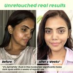 Buy PLIX Pineapple De-pigmentation Skincare Kit For Dark Spot Removal | Cleanser (100 ml), Face Serum (30 ml) and Moisturizer (50 gm) Combo With 2% Alpha Arbutin For Women & Men, Combo of 3 - Purplle