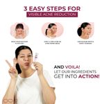 Buy Alite Anti Acne Gel | Fast Action on Acne & Pimples | Boosts Skin Health & Helps Manage Acne & Breakouts 15 gm - Purplle