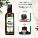 Buy Nutrainix Organics Ayurvedic Hair Revival Tonic, Scalp Elixir for Thicker, Stronger Hair – Comb Applicator Included - 100 ml - Purplle