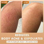 Buy mCaffeine 7% Exfoliating Body Wash | 1% Salicylic Acid & 2% Lactic Acid Reduces Body Acne, Strawberry Skin & Smoothes | Sweet Caramel Fragrance- 300 ml - Purplle