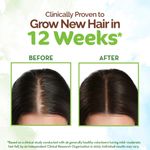 Buy Mamaearth Rosemary Hair Growth Oil with Rosemary & Methi Dana for Promoting Hair Growth - 150 ml (Pack of 2) - Purplle
