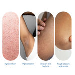 Buy Be Bodywise 7% Glycolic Acid Exfoliating Body Stick - For KP Bumps, Ingrown Hair & Rough Skin- 30 gm - Purplle