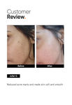 Buy Minimalist Niacinamide 05% Face Serum 10 ml - Purplle