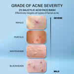 Buy DERMDOC 2% Salicylic Acid Face Wash (120 ml) | Oily, Sensitive & Acne Prone Skin Friendly | Clears Pimples, Dark Spots, Whiteheads & Blackheads | Gentle Exfoliation - Purplle