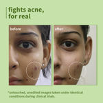 Buy Plum Green Tea For Oily, Acne-Prone Skin | Controls Oil, Fights Pimples | Non-Drying Face Wash (75 ml) - Purplle
