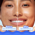 Buy Aqualogica Bright+ Hydra Gel Moisturizer with Blueberry & Kojic Acid - 200 gm - Purplle