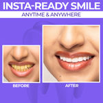 Buy Sanfe Purple Teeth Whitening Gel | Instant Stain Removal & Brightening | Neutralizes Yellow Tones | Safe on Enamel | Gentle Daily Formula | Easy-to-Use | Confident White Smile, 30 gm - Purplle