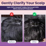 Buy Sanfe Intant Dandruff Removal Gel, Anti Dandruff | Soothes Itchy Scalp | Reduces Flakes & Irritation | Non-Sticky, Wash-Off Formula | Promotes Healthy Hair Growth | With Menthol and Lemon, 100 gm - Purplle