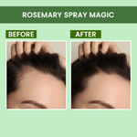Buy Alps Goodness Rosemary Revive Kit I Rosemary Water Spray (100 ml) + Rosemary Essential Oil (10 ml) + Scalp Massager I Hair Growth Expert I For Skin & Hair I Fights Acne I Improves Scalp Health Combo of 2 - Purplle