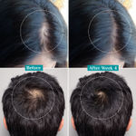 Buy Pilgrim 3% Redensyl & 4% Anagain Advance Hair Growth Serum|Thick Hair|Korean Black Rice (30 ml) - Purplle