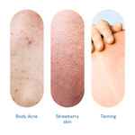 Buy Be Bodywise Acne & Exfoliation Duo (1% Salicylic Acid Body Wash 250 ml + 10% AHA Body Scrub 300 gm) | For Exfoliating Detanning Preventing Body Acne,Combo of 2 Skincare Kit - Purplle