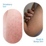 Buy Be Bodywise Strawberry Skin Pack (Body wash 250 ml, scrub 200 gm & Body lotion 200 ml) | Fights Keratosis Pilaris Tiny Bumps & Strawberry Skin(Combo of 3) Skincare Kit - Purplle