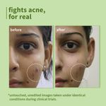 Buy Plum Green Tea Cleanse and Repair Combo of 2 - Night Gel 15 ml, Face wash 75 ml - Skincare Kit - Purplle