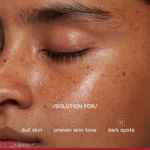 Buy Proven Honest Derma (PHD) 10% Vitamin C Brightening Serum - 30 ml - Purplle