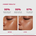 Buy Proven Honest Derma (PHD) 10% Vitamin C Brightening Serum - 30 ml - Purplle