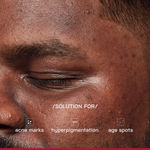 Buy Proven Honest Derma (PHD) 2% Alpha Arbutin Depigmentation Serum - 30 ml - Purplle