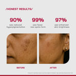 Buy Proven Honest Derma (PHD) 2% Alpha Arbutin Depigmentation Serum - 30 ml - Purplle