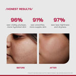 Buy Proven Honest Derma (PHD) 2% Hyaluronic Acid Dewy Skin Serum - 30 ml - Purplle