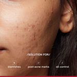 Buy Proven Honest Derma (PHD) 10% Niacinamide Spot Correcting Serum - 30 ml - Purplle