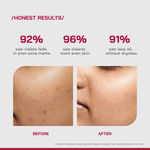 Buy Proven Honest Derma (PHD) 10% Niacinamide Spot Correcting Serum - 30 ml - Purplle