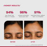 Buy Proven Honest Derma (PHD) 0.3% Pure Retinol Face Serum - 30 ml - Purplle