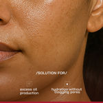 Buy Proven Honest Derma (PHD) 3% Niacinamide Oil-Free Moisturizer - 50 gm - Purplle