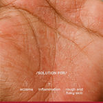 Buy Proven Honest Derma (PHD) 1% Ceramides Intensive Repair Cream - 50 gm - Purplle