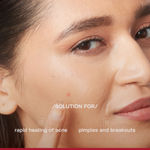 Buy Proven Honest Derma (PHD) Salicylic Acid Acne Spot Treatment Gel - 10 gm - Purplle