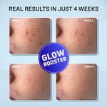 Buy DERMDOC Combo Kit 2% Kojic Acid Glow Fusion Formula Night Cream (50 gm * Pack of 2) | Skin Brightening I Targets Pigmentation I With Niacinamide & Alpha Arbutin Brightening - Purplle