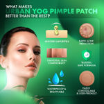 Buy UrbanYog Acne Pimple Patch| Salicylic Acid Hydrocolloid Pimple Patches For Face- Acne Treatment Clear Skin Pimple Patch - 36 Dots - Purplle