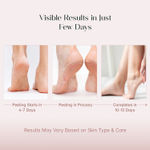 Buy SeoulSkin Glycolic Acid Foot Peeling Mask (1 pc), Korean Peeling & Exfoliating | Deep Exfoliation with Glycolic Acid, Removes Dead Skin, Cruelty-Free, Foot Peel Off Mask - Purplle