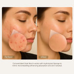 Buy Seoulskin Snail Mucin Micro-needling Serum 7500 PPM - Powerful Hydration with Hyaluronic Acid & Centella Asiatica - Accelerated Rejuvenation, Cruelty-Free & Non-Comedogenic for All Skin Types (30 gm) - Purplle