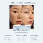 Buy SeoulSkin Zero Pore Pads | Dual-Textured Exfoliating & Hydrating Toner Pads | AHA + BHA + Allantoin | Reduces Blackheads, Oil & Pore Visibility | 70 gm - Purplle