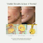 Buy SeoulSkin Heartleaf Pore Cleansing Oil | Removes Makeup, SPF & Excess Sebum | Lightweight, Non-Stripping Oil Face Cleanser | 150 ml - Purplle