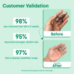 Buy Aravi Organic Rosemary Anti-Hairfall Shampoo | Hair Growth & Hairfall Control | Up to 94% Stronger Hair | Sulfate-Free | Suitable for Men & Women | For All Hair Types – 200 ml - Purplle